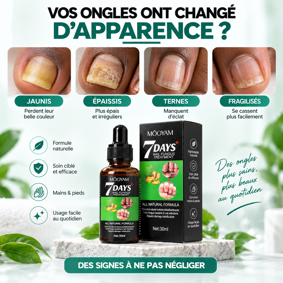 Sérum Réparateur des Ongles Abîmés & Jaunis™ MOOYAM