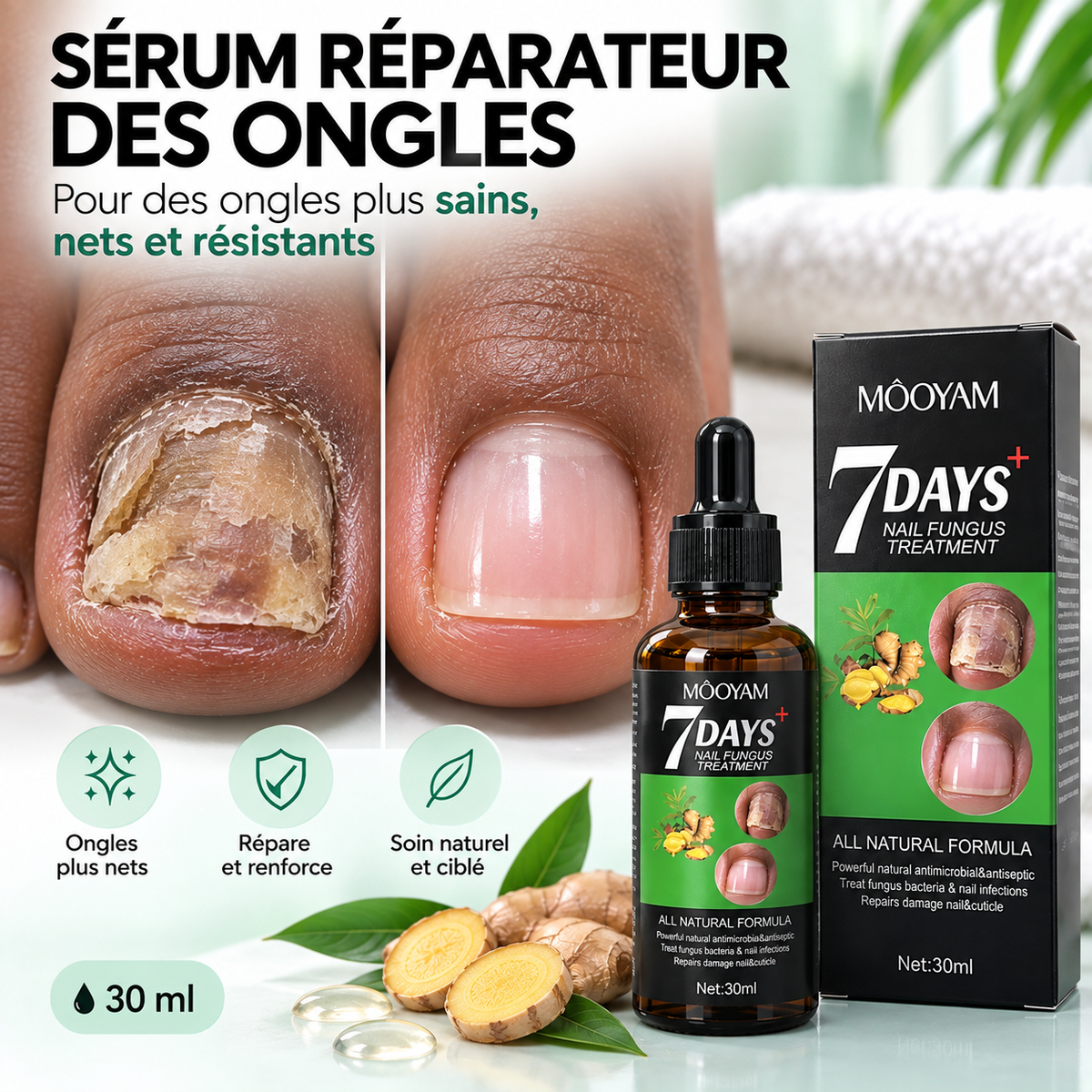 Sérum Réparateur des Ongles Abîmés & Jaunis™ MOOYAM