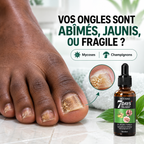 Sérum Réparateur des Ongles Abîmés & Jaunis™ MOOYAM