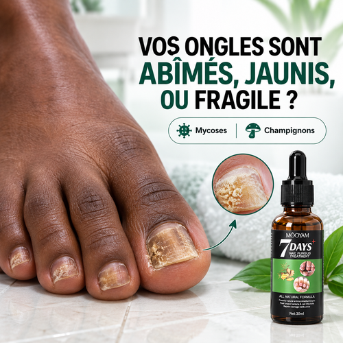 Sérum Réparateur des Ongles Abîmés & Jaunis™ MOOYAM