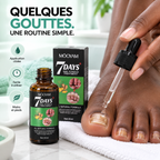 Sérum Réparateur des Ongles Abîmés & Jaunis™ MOOYAM